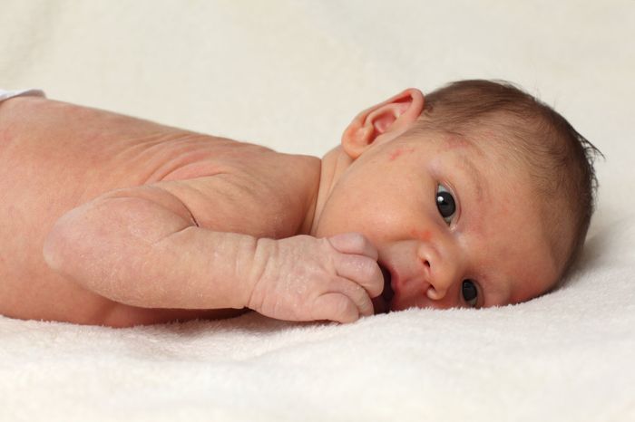 Аллергическая сыпь на теле у новорожденного
