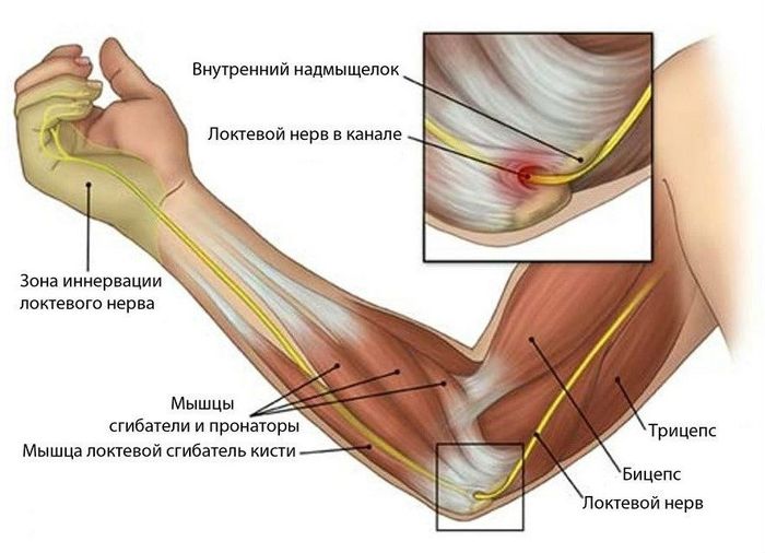 Изображение - Лечение сустава локтя bol-v-loktevyh-sustavah_2