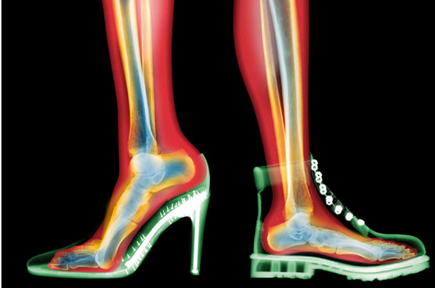 Рентгеновский снимок ног в обуви
